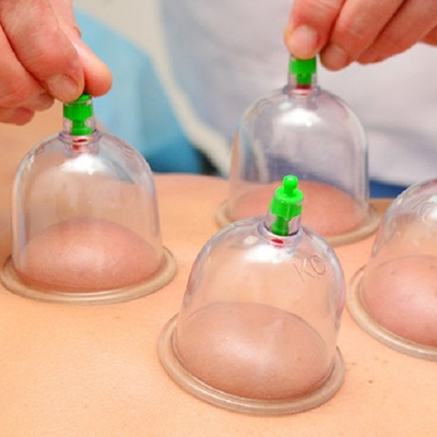 Feel Better Massage Chinese Cupping Services