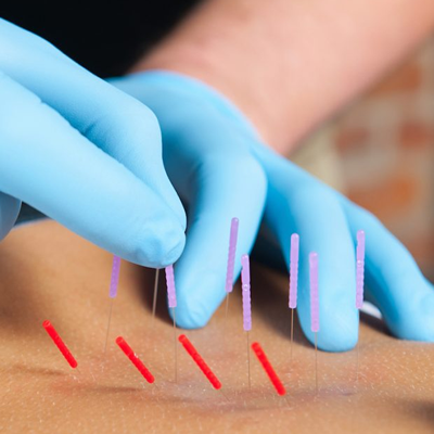 Feel Better Massage Dry Needling Services