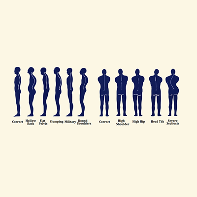 Feel Better Massage Posture Analysis Services